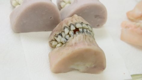 zombie teeth